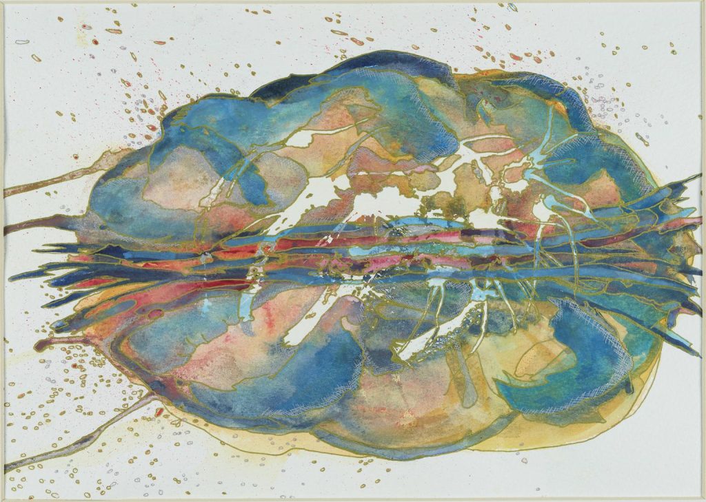 A Closer Look at Stroke: Causes, Symptoms, and Advances in Diagnosis